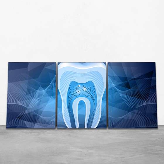 Quadro dentista dente azul decorativo